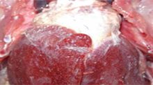 Fatty liver kidney Syndrome (FLKS)